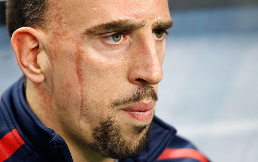 Pháp: Franck Ribéry – Chính trị bóng đá / Chính trị bóng đá